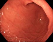 ������������� �����������